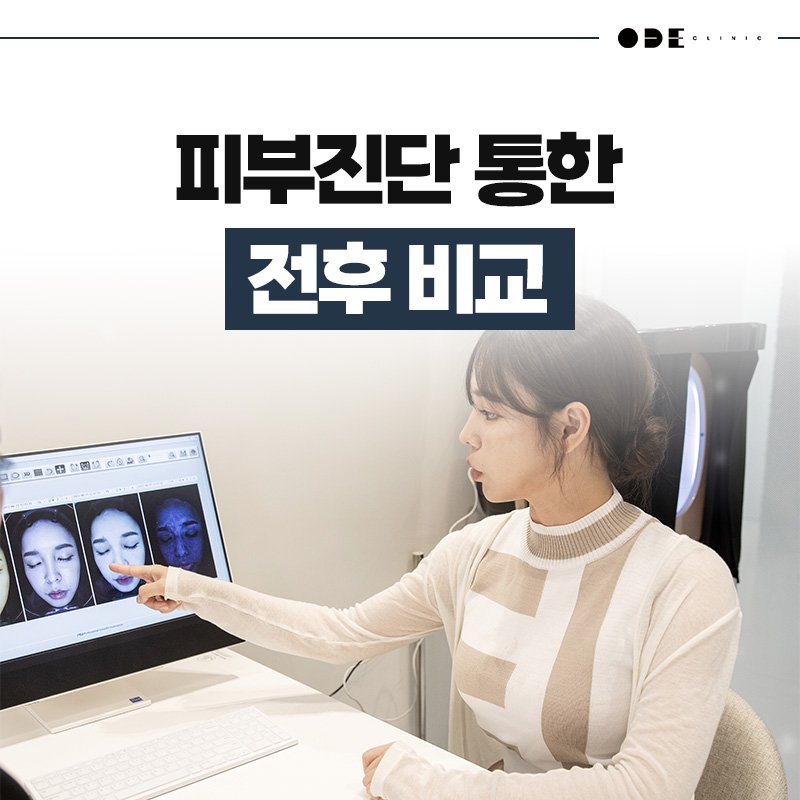 Quality Dermatology Services for Expats in Gangnam